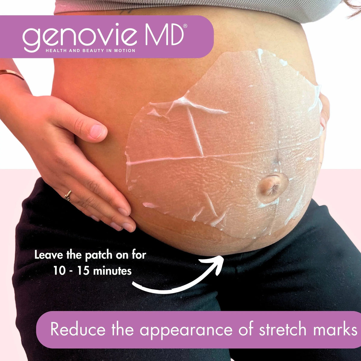 GENOVIE MD Maternal Miracle Stretch Mark Patch